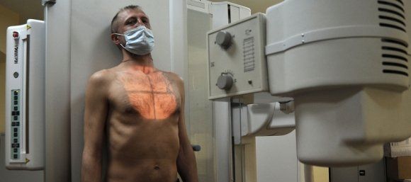«Заразы нам не надо!» На Кубани четыре человека с туберкулёзом были принудительно отправлены на госпитализацию