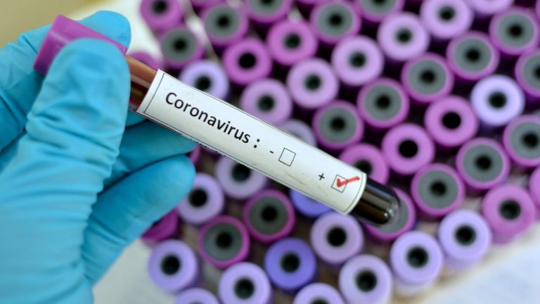 На Кубани зарегистрировали 103 случая заболевания коронавирусом