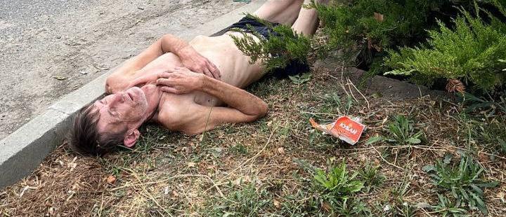 «У него анорексия, а возле ног – открытый люк!» На Кубани люди обеспокоены здоровьем худого мужчины, который лежит около дороги - медикам до него нет дела