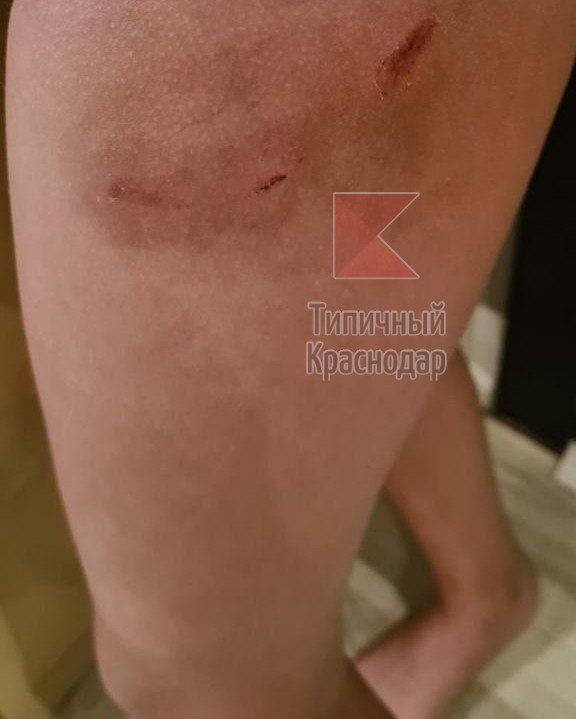 В Краснодаре псы напали на второклассницу на территории её лицея.jpg
