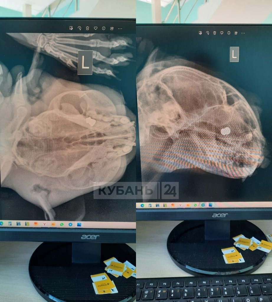 Рентгеновские снимки.jpg