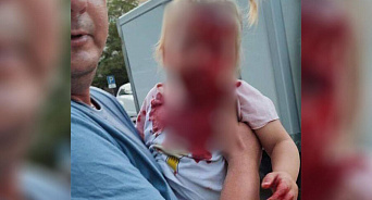 В Крыму родственница местного олигарха на электросамокате въехала в детскую коляску и скрылась с места происшествия – пострадала 3-летняя девочка