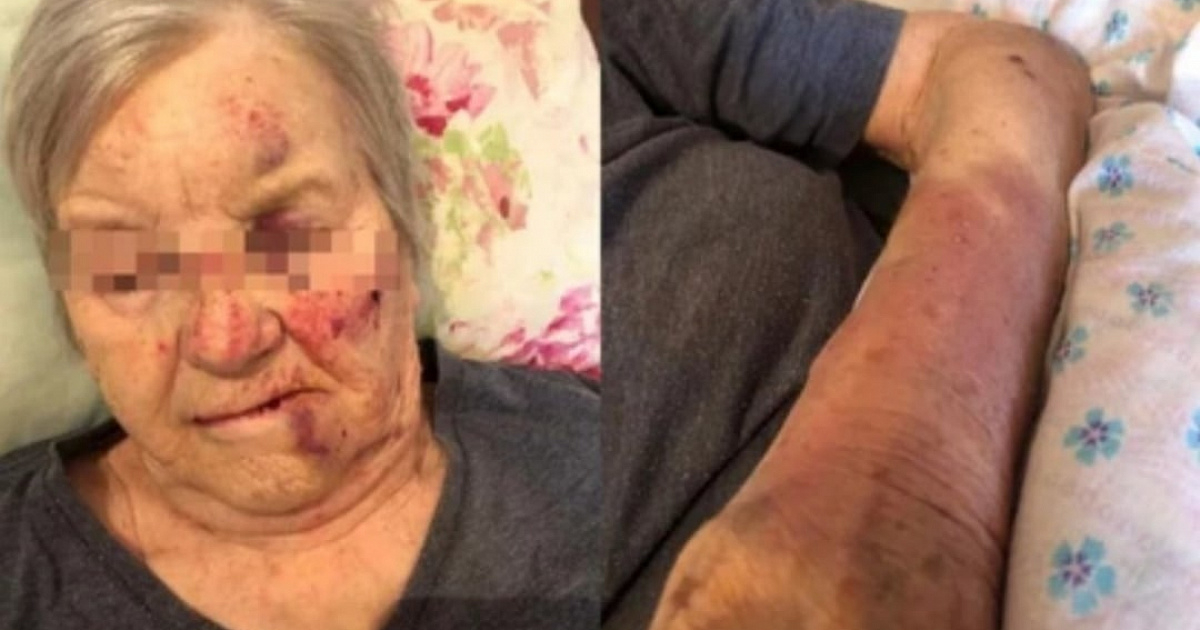 Бывшая узница концлагеря пострадала при нападении в пансионате Новосибирска