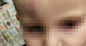 В частном детском саду Краснодара дети избили 2-летнего мальчика