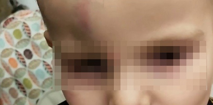 В частном детском саду Краснодара дети избили 2-летнего мальчика