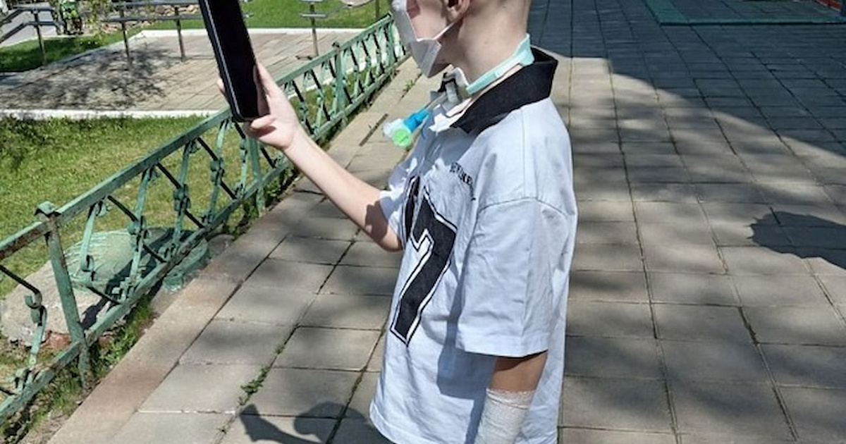 Девятилетнему мальчику из Сочи присвоили инвалидность после укуса собак