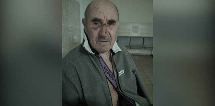 В Краснодаре в Дендрарии девочка на электросамокате сбила 84-летнего мужчину